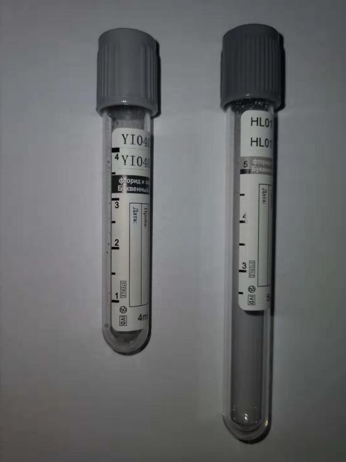 Fluoride Potassium XalateFluoride Heparin
