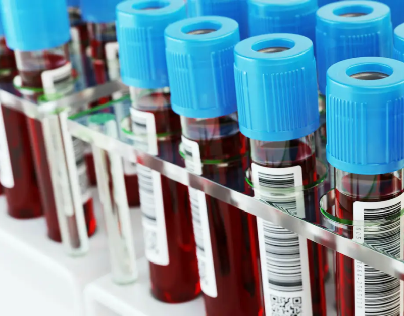 Качество российских вакуумных пробирок для взятия венозной крови UNIVAC® не уступает лучшим зарубежным аналогам - подтвердили клинические исследования.